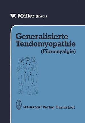 Generalisierte Tendomyopathie (Fibromyalgie)