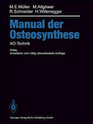 Manual der OSTEOSYNTHESE