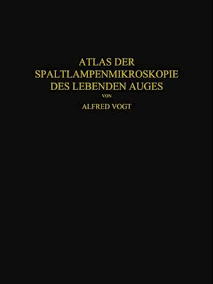 Atlas der Spaltlampenmikroskopie des Lebenden Auges