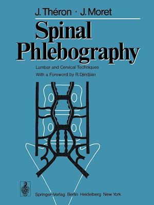 Spinal Phlebography