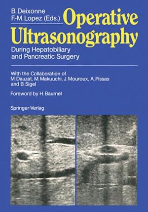 Operative Ultrasonography