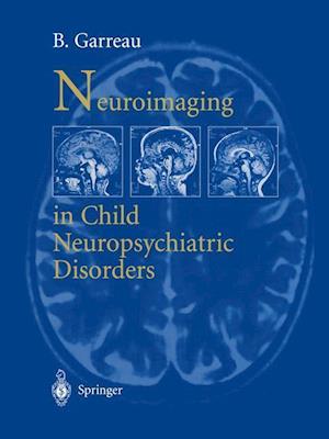 Neuroimaging in child neuropsychiatric disorders