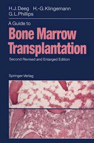 Guide to Bone Marrow Transplantation