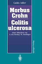Morbus Crohn Colitis ulcerosa