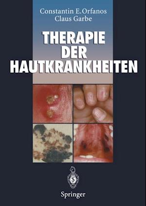 Therapie der Hautkrankheiten