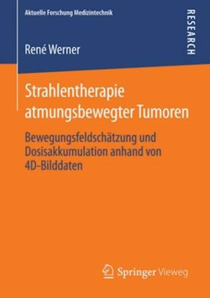 Strahlentherapie atmungsbewegter Tumoren