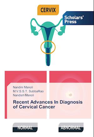 Recent Advances In Diagnosis of Cervical Cancer