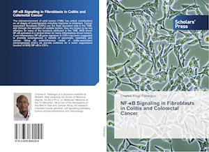 NF-¿B Signaling in Fibroblasts in Colitis and Colorectal Cancer