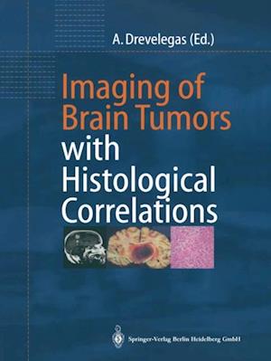 Imaging of Brain Tumors with Histological Correlations