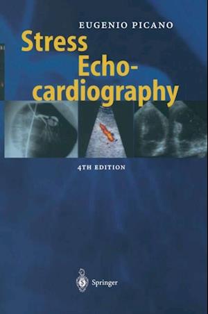 Stress Echocardiography