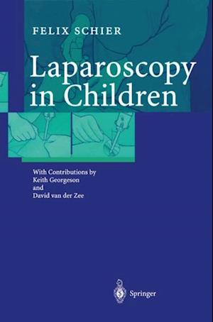 Laparoscopy in Children