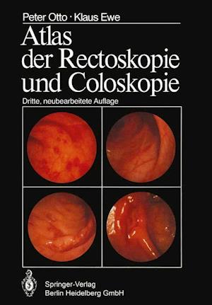 Atlas der Rectoskopie und Coloskopie