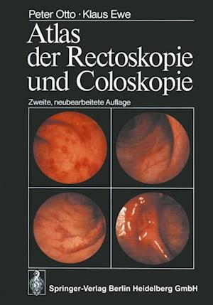 Atlas der Rectoskopie und Coloskopie