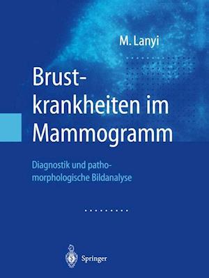 Brustkrankheiten Im Mammogramm