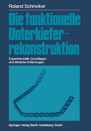 Die funktionelle Unterkieferrekonstruktion