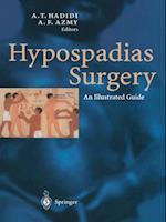 Hypospadias Surgery