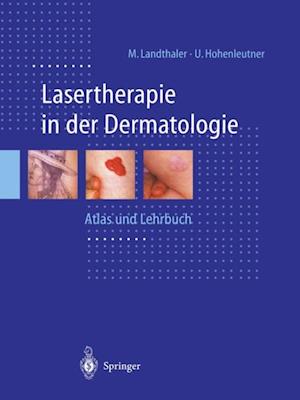 Lasertherapie in der Dermatologie