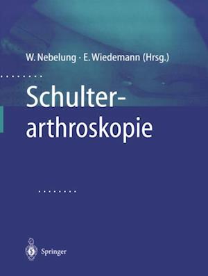 Schulterarthroskopie