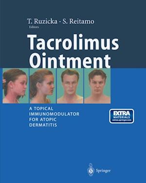 Tacrolimus Ointment