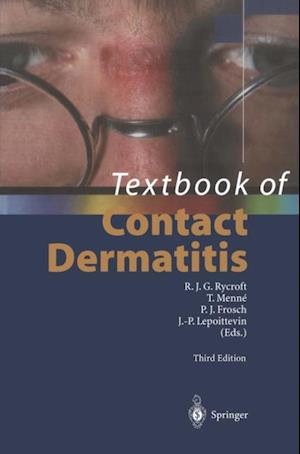 Textbook of Contact Dermatitis