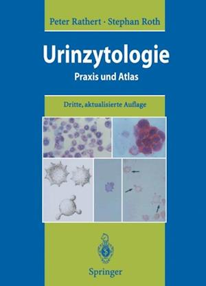 Urinzytologie