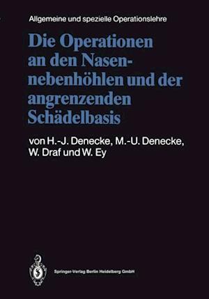 Die Operationen an den Nasennebenhöhlen und der angrenzenden Schädelbasis