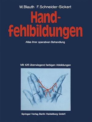 Handfehlbildungen