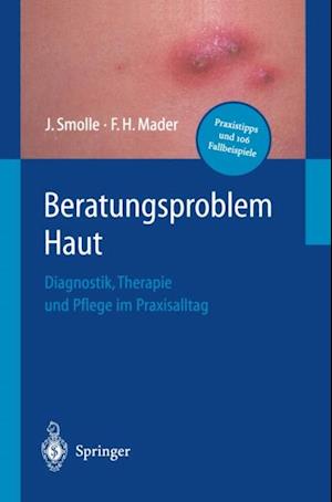 Beratungsproblem Haut