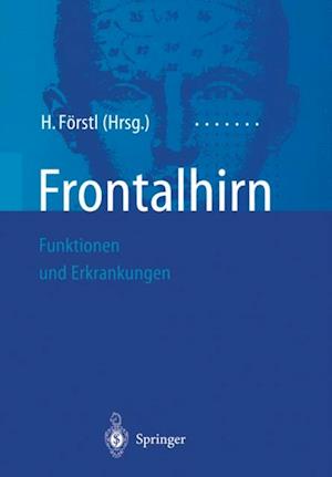 Frontalhirn