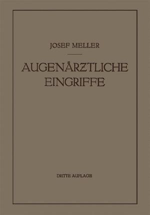 Augenärztliche Eingriffe