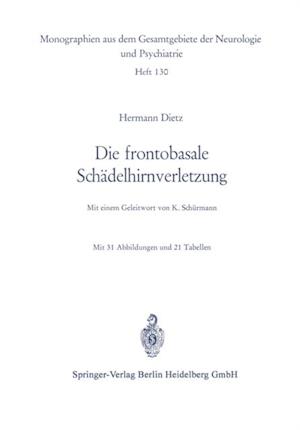 Die frontobasale Schädelhirnverletzung