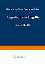 Augenärztliche Eingriffe