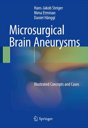 Microsurgical Brain Aneurysms