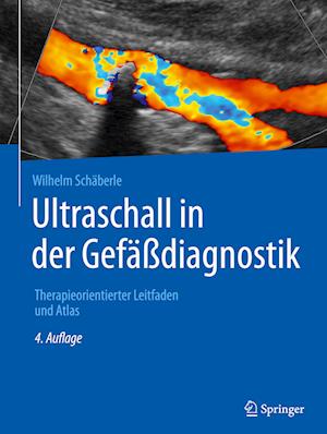 Ultraschall in der Gefäßdiagnostik