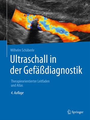 Ultraschall in der Gefäßdiagnostik