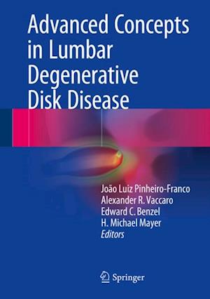 Advanced Concepts in Lumbar Degenerative Disk Disease