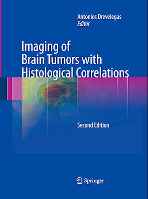 Imaging of Brain Tumors with Histological Correlations