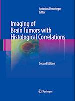 Imaging of Brain Tumors with Histological Correlations