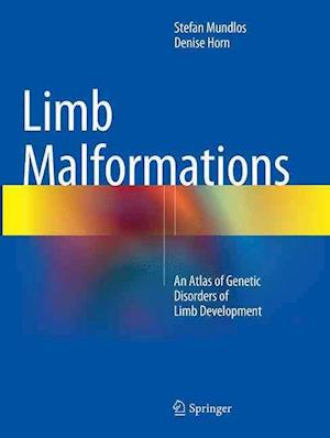 Limb Malformations