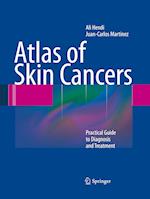 Atlas of Skin Cancers