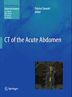 CT of the Acute Abdomen