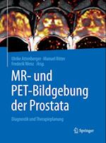 MR- und PET-Bildgebung der Prostata