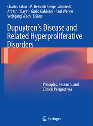 Dupuytren’s Disease and Related Hyperproliferative Disorders