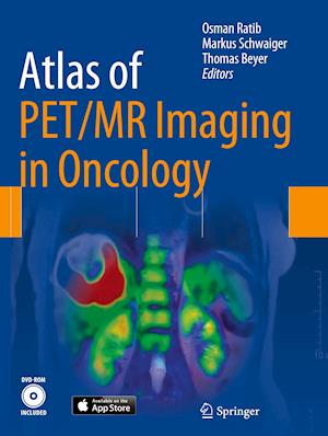 Atlas of PET/MR Imaging in Oncology