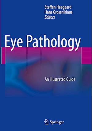 Eye Pathology