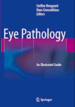 Eye Pathology