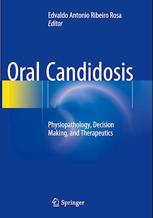 Oral Candidosis