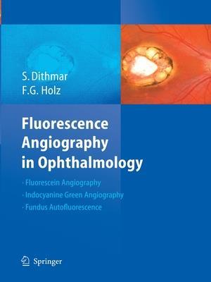 Fluorescence Angiography in Ophthalmology