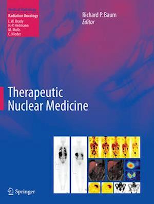 Therapeutic Nuclear Medicine