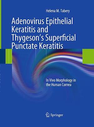 Adenovirus Epithelial Keratitis and Thygeson's Superficial Punctate Keratitis
